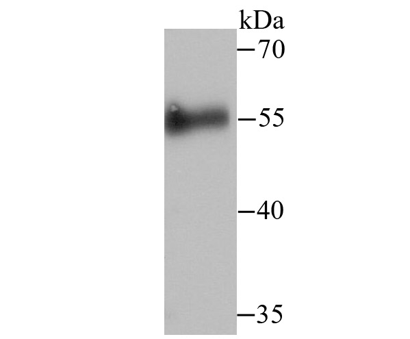 Western blot analysis of Cdc25C on human skin tissue lysate using anti-Cdc25C antibody at 1/500 dilution.