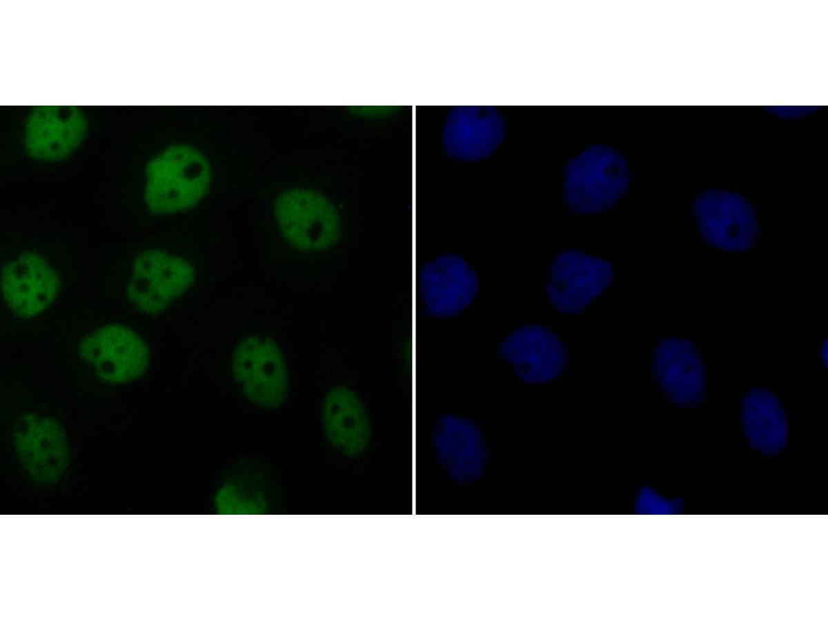 ICC staining Cdc25C in A431 cells (green). The nuclear counter stain is DAPI (blue). Cells were fixed in paraformaldehyde, permeabilised with 0.25% Triton X100/PBS.