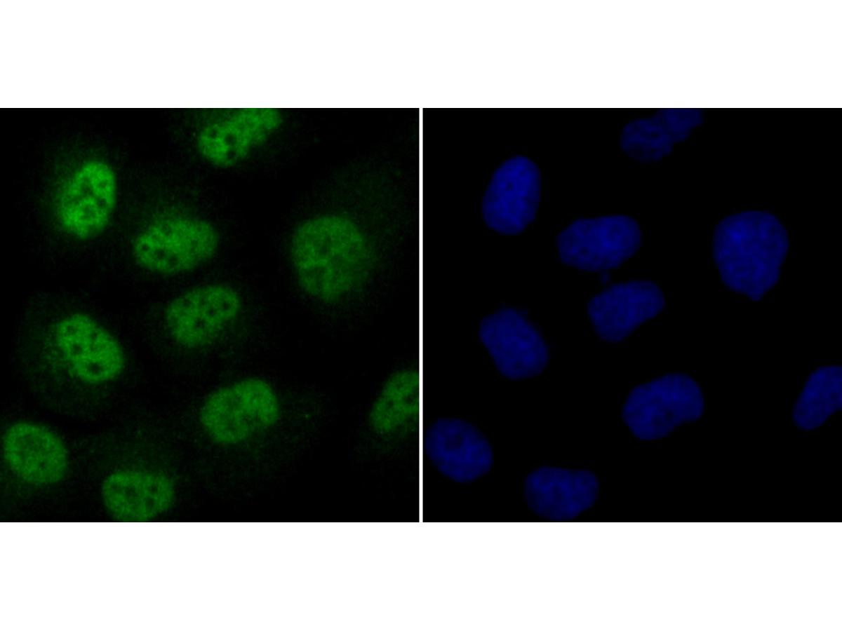 ICC staining Cdc25C in HUVEC cells (green). The nuclear counter stain is DAPI (blue). Cells were fixed in paraformaldehyde, permeabilised with 0.25% Triton X100/PBS.