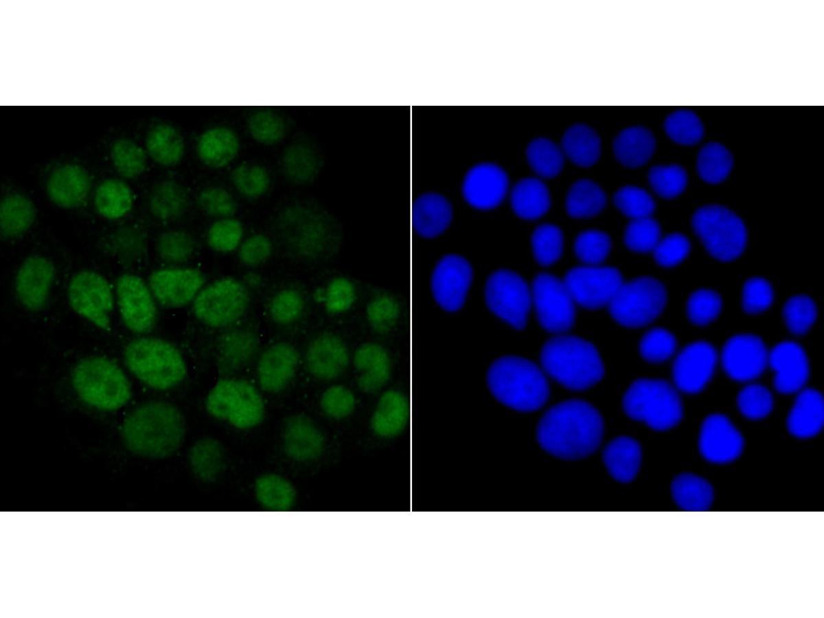 ICC staining Cdc25C in LOVO cells (green). The nuclear counter stain is DAPI (blue). Cells were fixed in paraformaldehyde, permeabilised with 0.25% Triton X100/PBS.