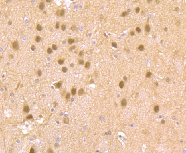 Immunohistochemical analysis of paraffin-embedded rat brain tissue using anti-Cdc25C antibody. Counter stained with hematoxylin.