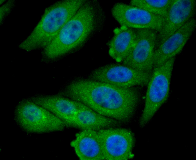 ICC staining GOLPH3 in HepG2 cells (green). The nuclear counter stain is DAPI (blue). Cells were fixed in paraformaldehyde, permeabilised with 0.25% Triton X100/PBS.