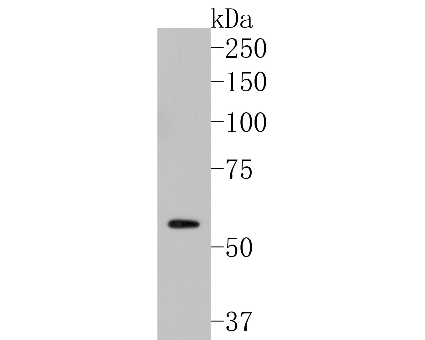 Western blot analysis of MMP9 on U937 cell lysates. Proteins were transferred to a PVDF membrane and blocked with 5% BSA in PBS for 1 hour at room temperature. The primary antibody (ER1706-40, 1/500) was used in 5% BSA at room temperature for 2 hours. Goat Anti-Rabbit IgG - HRP Secondary Antibody (HA1001) at 1:5,000 dilution was used for 1 hour at room temperature.
