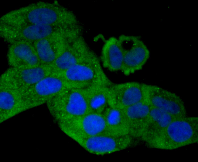 ICC staining of MMP9 in Hela cells (green). Formalin fixed cells were permeabilized with 0.1% Triton X-100 in TBS for 10 minutes at room temperature and blocked with 1% Blocker BSA for 15 minutes at room temperature. Cells were probed with the primary antibody (ER1706-40, 1/50) for 1 hour at room temperature, washed with PBS. Alexa Fluor®488 Goat anti-Rabbit IgG was used as the secondary antibody at 1/1,000 dilution. The nuclear counter stain is DAPI (blue).