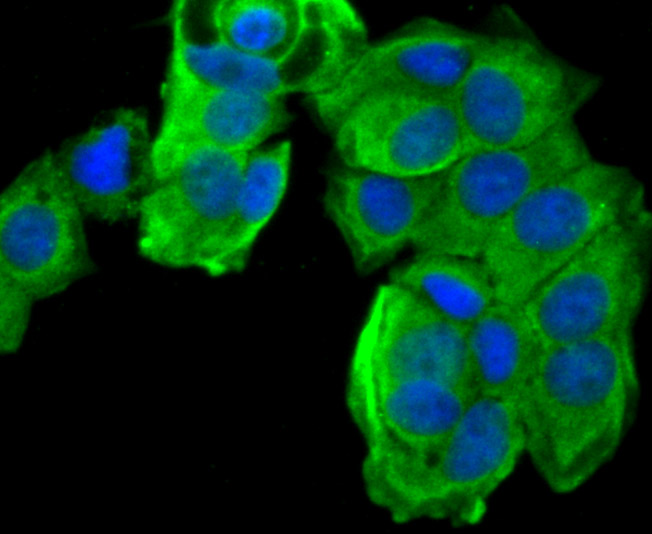 ICC staining of MMP9 in MCF-7 cells (green). Formalin fixed cells were permeabilized with 0.1% Triton X-100 in TBS for 10 minutes at room temperature and blocked with 1% Blocker BSA for 15 minutes at room temperature. Cells were probed with the primary antibody (ER1706-40, 1/50) for 1 hour at room temperature, washed with PBS. Alexa Fluor®488 Goat anti-Rabbit IgG was used as the secondary antibody at 1/1,000 dilution. The nuclear counter stain is DAPI (blue).