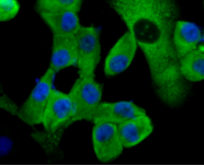 ICC staining of MMP9 in PANC-1 cells (green). Formalin fixed cells were permeabilized with 0.1% Triton X-100 in TBS for 10 minutes at room temperature and blocked with 1% Blocker BSA for 15 minutes at room temperature. Cells were probed with the primary antibody (ER1706-40, 1/50) for 1 hour at room temperature, washed with PBS. Alexa Fluor®488 Goat anti-Rabbit IgG was used as the secondary antibody at 1/1,000 dilution. The nuclear counter stain is DAPI (blue).