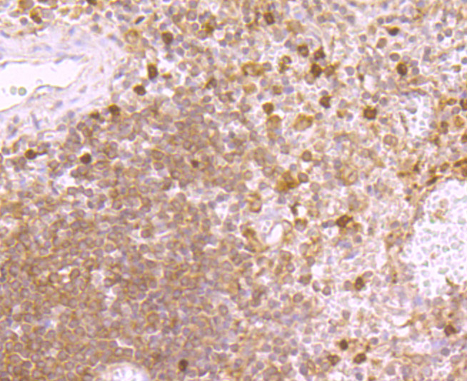 Immunohistochemical analysis of paraffin-embedded human spleen tissue using anti-MMP9 antibody. The section was pre-treated using heat mediated antigen retrieval with Tris-EDTA buffer (pH 8.0-8.4) for 20 minutes.The tissues were blocked in 5% BSA for 30 minutes at room temperature, washed with ddH2O and PBS, and then probed with the primary antibody (ER1706-40, 1/50) for 30 minutes at room temperature. The detection was performed using an HRP conjugated compact polymer system. DAB was used as the chromogen. Tissues were counterstained with hematoxylin and mounted with DPX.