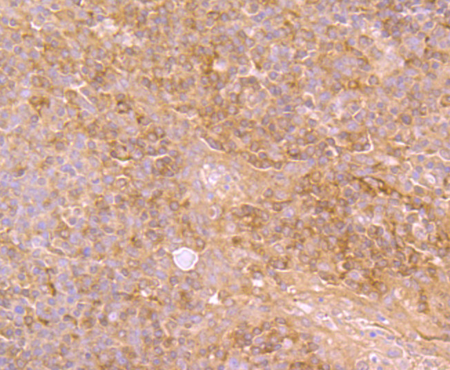 Immunohistochemical analysis of paraffin-embedded human tonsil tissue using anti-MMP9 antibody. The section was pre-treated using heat mediated antigen retrieval with Tris-EDTA buffer (pH 8.0-8.4) for 20 minutes.The tissues were blocked in 5% BSA for 30 minutes at room temperature, washed with ddH2O and PBS, and then probed with the primary antibody (ER1706-40, 1/50) for 30 minutes at room temperature. The detection was performed using an HRP conjugated compact polymer system. DAB was used as the chromogen. Tissues were counterstained with hematoxylin and mounted with DPX.