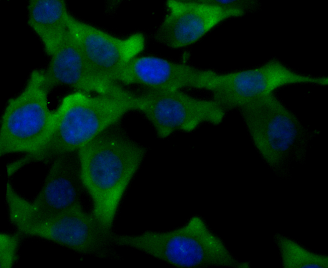 ICC staining TLR4 in PMVEC cells (green). The nuclear counter stain is DAPI (blue). Cells were fixed in paraformaldehyde, permeabilised with 0.25% Triton X100/PBS.