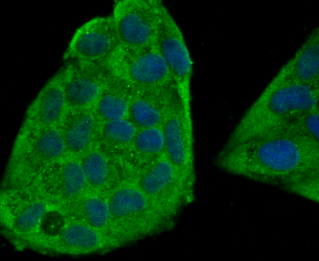 ICC staining TLR4 in Hela cells (green). The nuclear counter stain is DAPI (blue). Cells were fixed in paraformaldehyde, permeabilised with 0.25% Triton X100/PBS.
