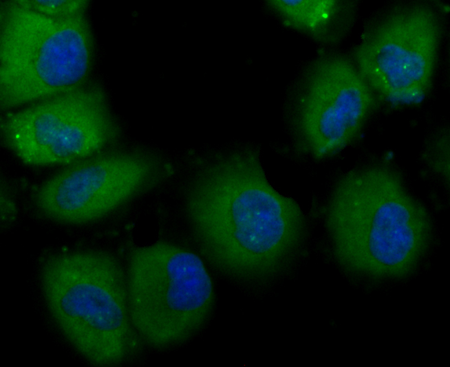 ICC staining TLR4 in HUVEC cells (green). The nuclear counter stain is DAPI (blue). Cells were fixed in paraformaldehyde, permeabilised with 0.25% Triton X100/PBS.