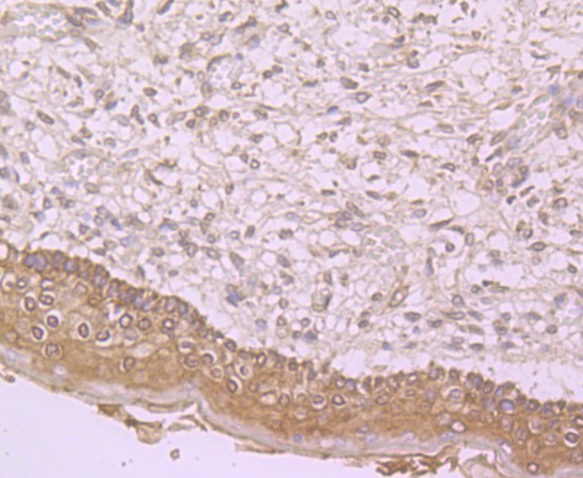 Immunohistochemical analysis of paraffin-embedded human skin tissue using anti-TLR4 antibody. Counter stained with hematoxylin.