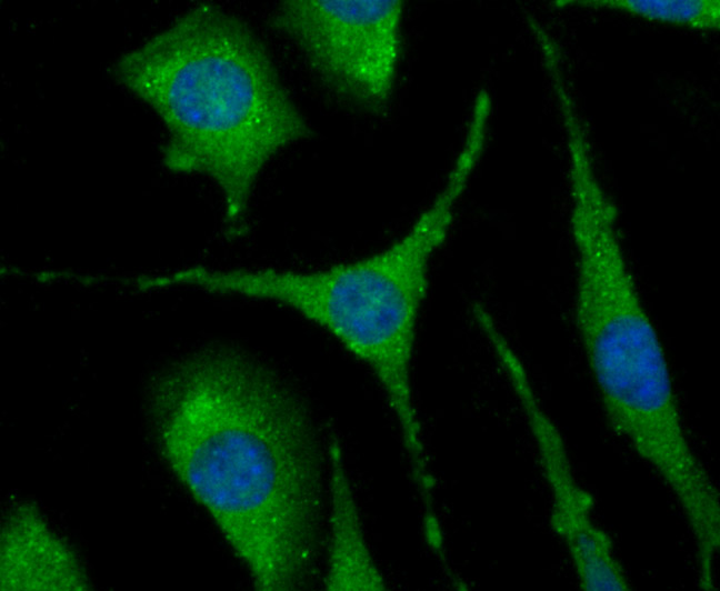 ICC staining NLRC3 in SH-SY5Y cells (green). The nuclear counter stain is DAPI (blue). Cells were fixed in paraformaldehyde, permeabilised with 0.25% Triton X100/PBS.