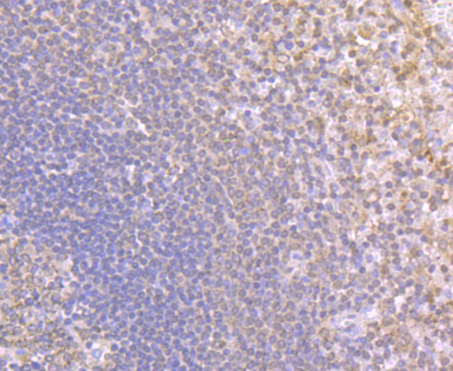 Immunohistochemical analysis of paraffin-embedded human spleen tissue using anti-NLRC3 antibody. Counter stained with hematoxylin.