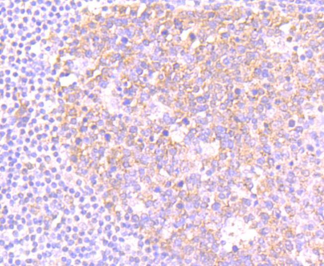 Immunohistochemical analysis of paraffin-embedded human tonsil tissue using anti-NLRC3 antibody. Counter stained with hematoxylin.