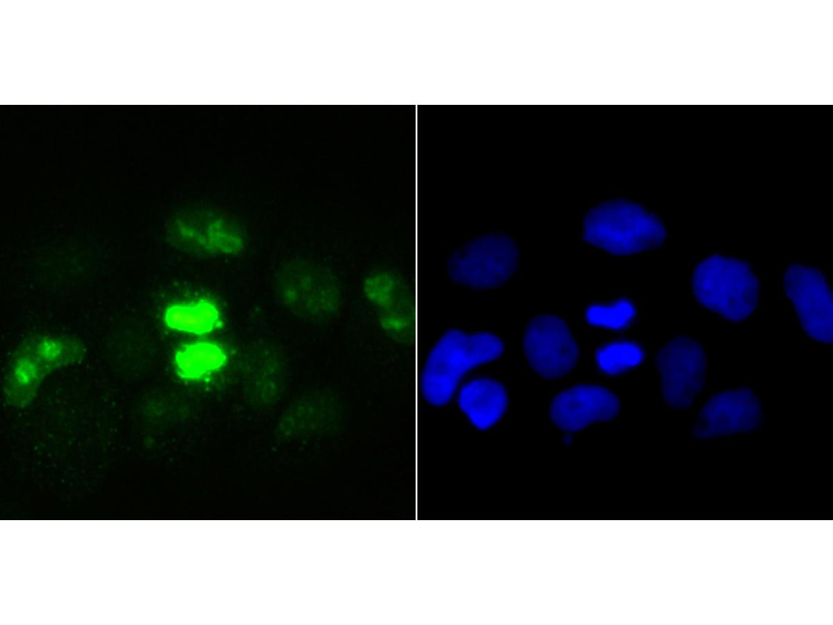 ICC staining Ki67 in A431 cells (green). The nuclear counter stain is DAPI (blue). Cells were fixed in paraformaldehyde, permeabilised with 0.25% Triton X100/PBS.