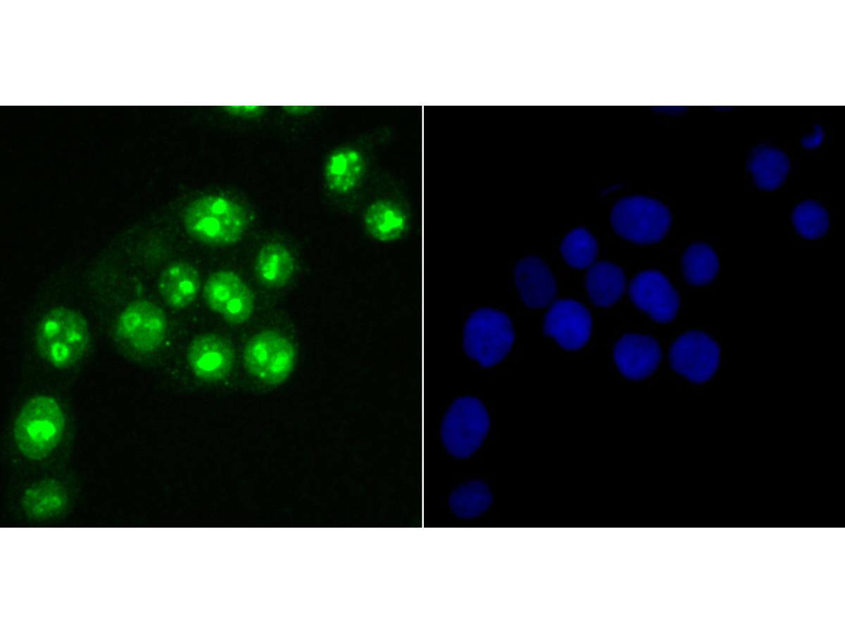 ICC staining Ki67 in LOVO cells (green). The nuclear counter stain is DAPI (blue). Cells were fixed in paraformaldehyde, permeabilised with 0.25% Triton X100/PBS.