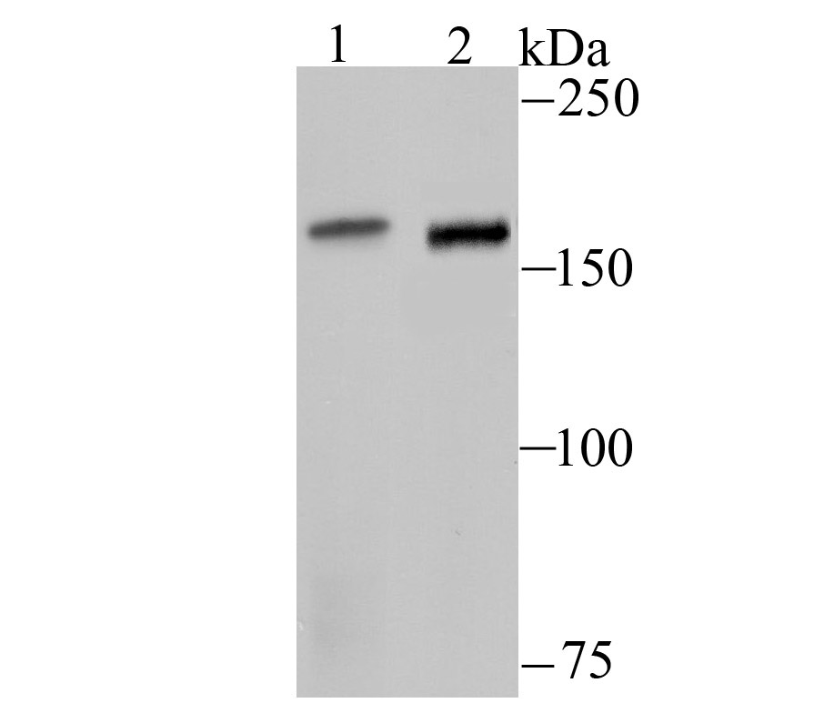 Western blot analysis of ROCK2 on Raji (1) and SiHa (2) cell lysates using anti-ROCK2 antibody at 1/500 dilution.