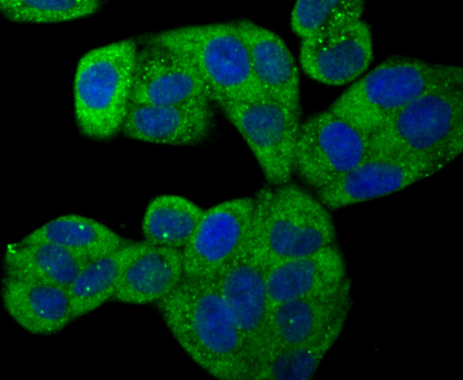 ICC staining ROCK2 in Hela cells (green). The nuclear counter stain is DAPI (blue). Cells were fixed in paraformaldehyde, permeabilised with 0.25% Triton X100/PBS.