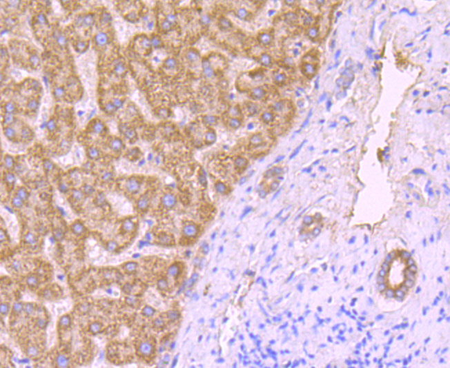 Immunohistochemical analysis of paraffin-embedded human liver tissue using anti-ROCK2 antibody. Counter stained with hematoxylin.