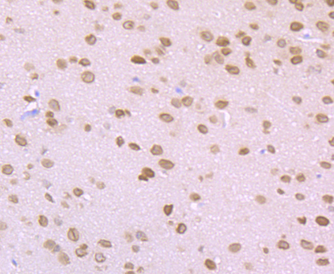 Immunohistochemical analysis of paraffin-embedded mouse brain tissue using anti-ROCK2 antibody. Counter stained with hematoxylin.