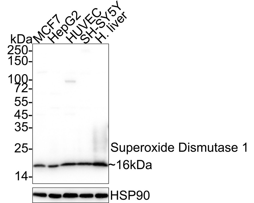 Western blot analysis of SOD1 on A549 cell lysate using anti-SOD1 antibody at 1/500 dilution.