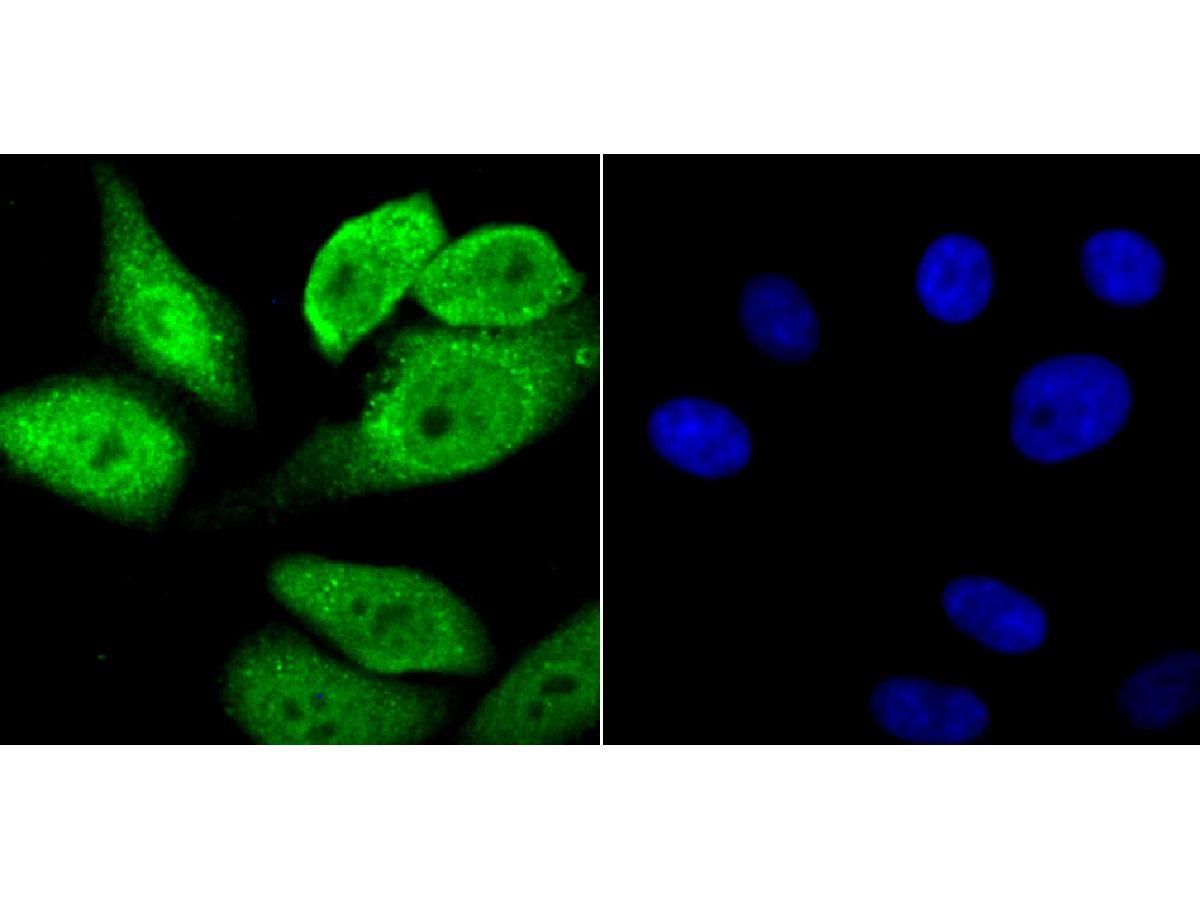 ICC staining SOD1 in HepG2 cells (green). The nuclear counter stain is DAPI (blue). Cells were fixed in paraformaldehyde, permeabilised with 0.25% Triton X100/PBS.
