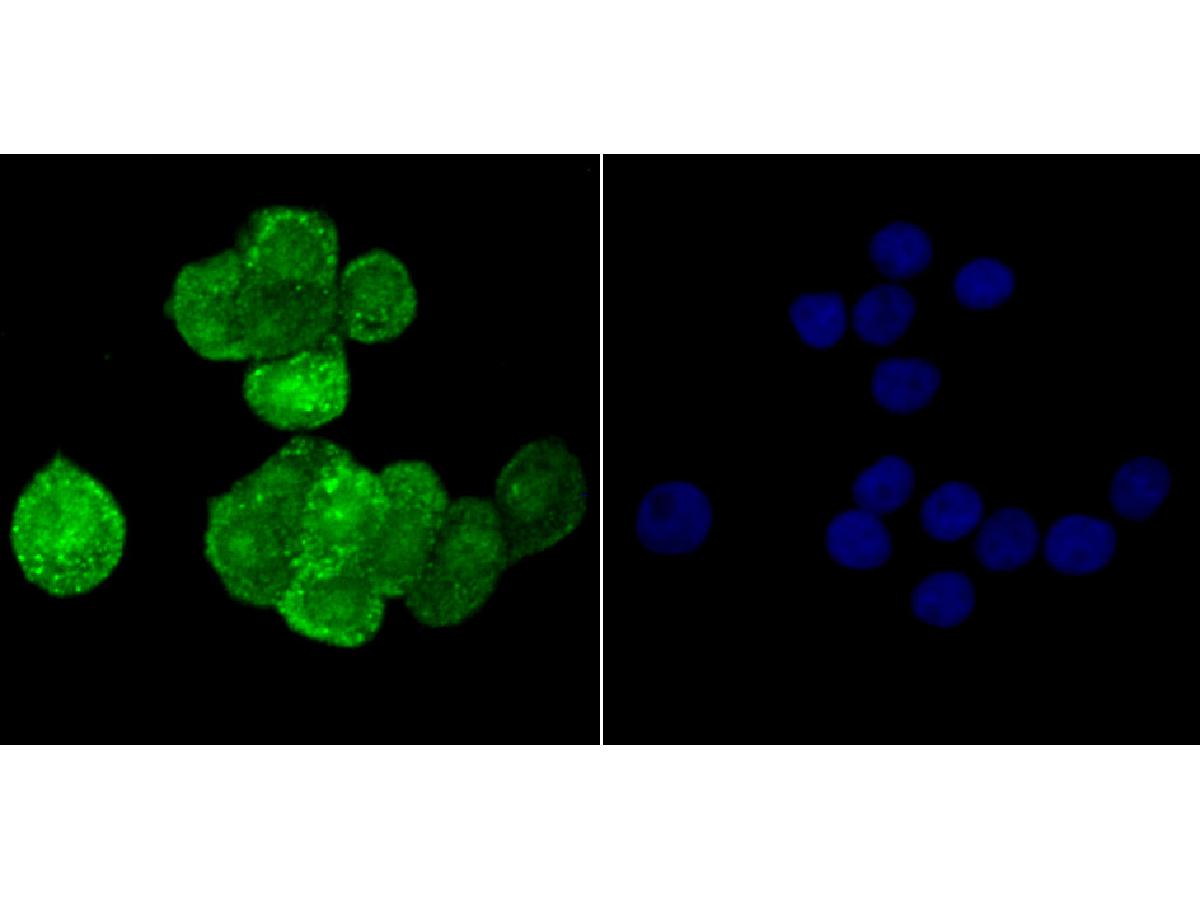 ICC staining SOD1 in LOVO cells (green). The nuclear counter stain is DAPI (blue). Cells were fixed in paraformaldehyde, permeabilised with 0.25% Triton X100/PBS.