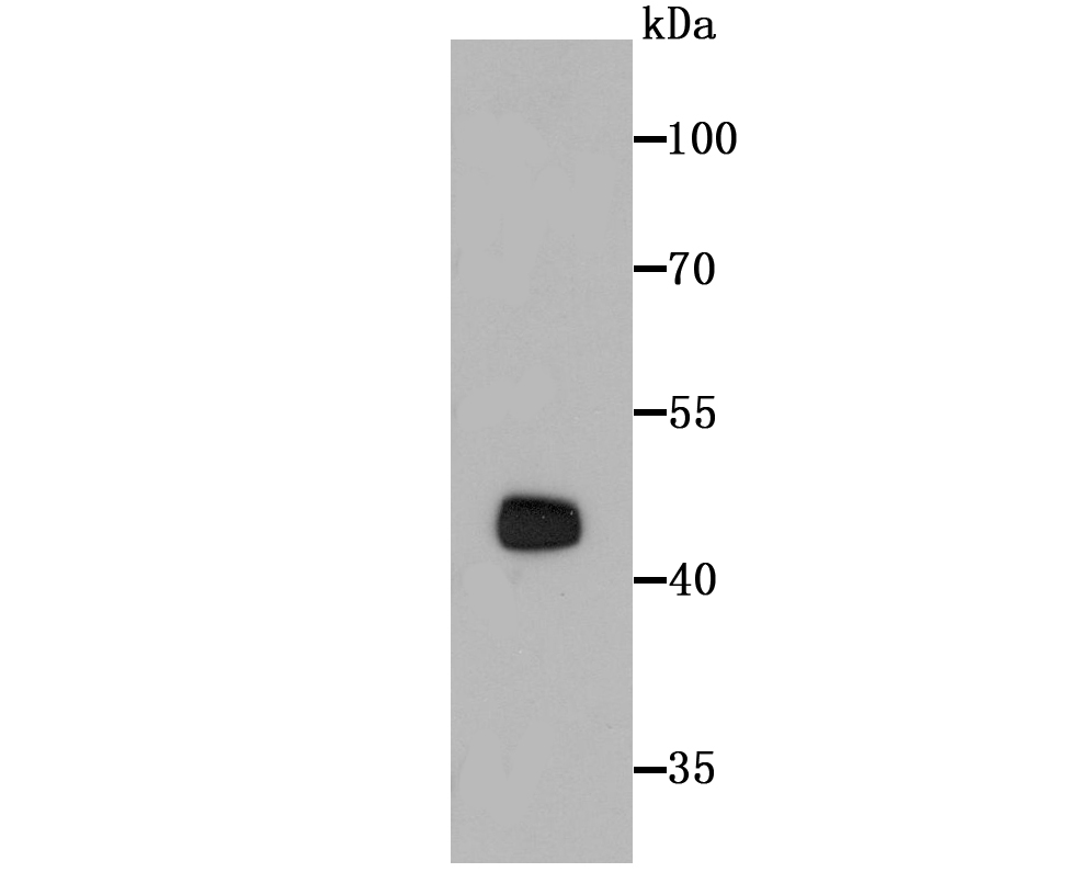 Western blot analysis of PTEN on MCF-7 cell lysates using anti-PTEN antibody at 1/500 dilution.