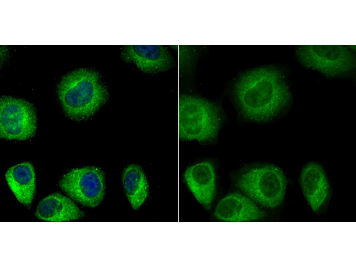 ICC staining PTEN in HUVEC cells (green). The nuclear counter stain is DAPI (blue). Cells were fixed in paraformaldehyde, permeabilised with 0.25% Triton X100/PBS.