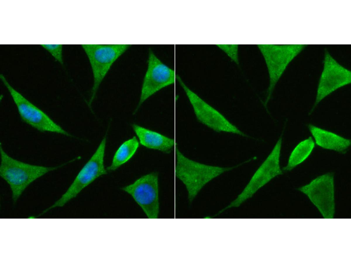 ICC staining PTEN in SH-SY5Y cells (green). The nuclear counter stain is DAPI (blue). Cells were fixed in paraformaldehyde, permeabilised with 0.25% Triton X100/PBS.