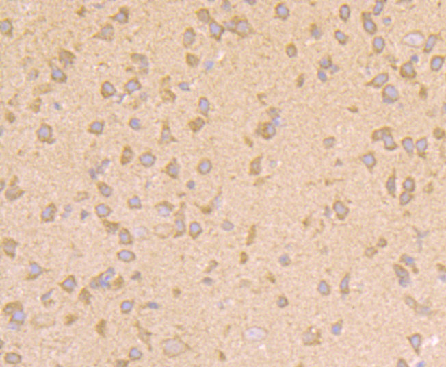Immunohistochemical analysis of paraffin-embedded mouse brain tissue using anti-PTEN antibody. Counter stained with hematoxylin.
