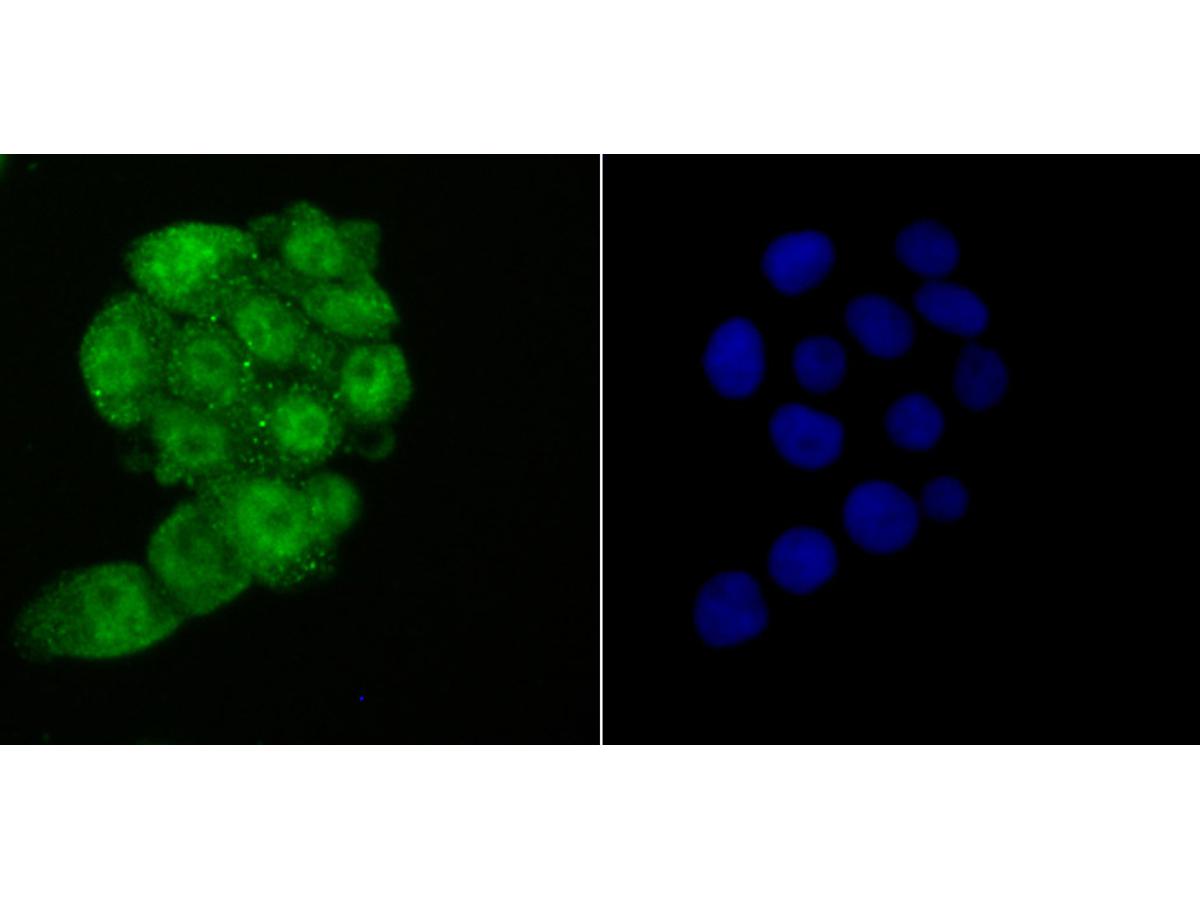 ICC staining HMGB2 in LOVO cells (green). The nuclear counter stain is DAPI (blue). Cells were fixed in paraformaldehyde, permeabilised with 0.25% Triton X100/PBS.