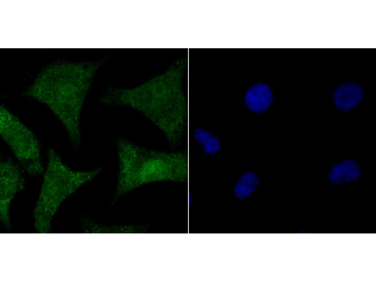ICC staining HMGB2 in SH-SY5Y cells (green). The nuclear counter stain is DAPI (blue). Cells were fixed in paraformaldehyde, permeabilised with 0.25% Triton X100/PBS.