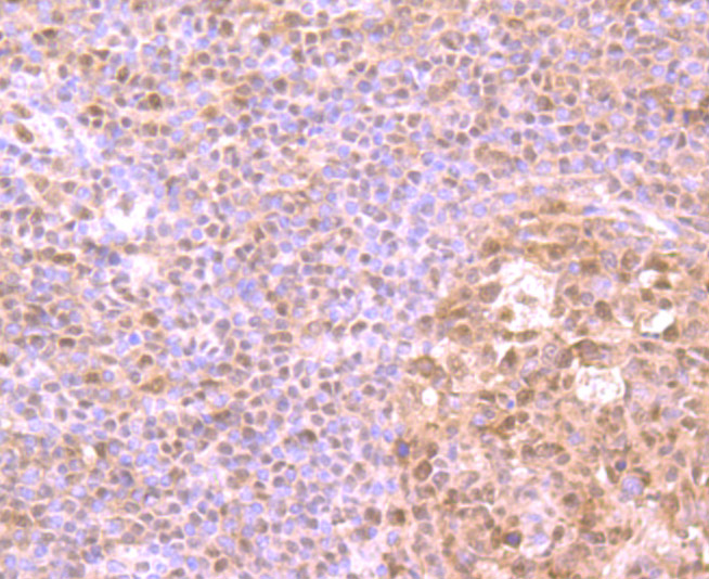 Immunohistochemical analysis of paraffin-embedded human tonsil tissue using anti-HMGB2 antibody. Counter stained with hematoxylin.