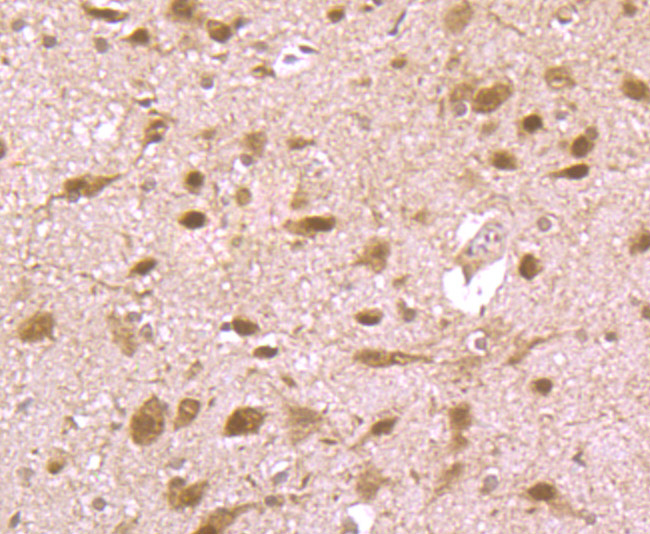 Immunohistochemical analysis of paraffin-embedded rat brain tissue using anti-HMGB2 antibody. Counter stained with hematoxylin.