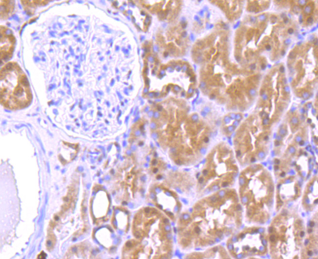 Immunohistochemical analysis of paraffin-embedded human kidney tissue using anti-HMGB2 antibody. Counter stained with hematoxylin.