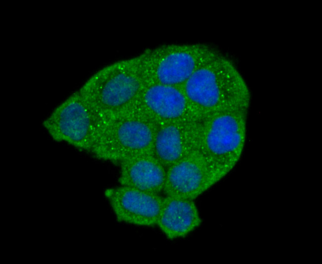 ICC staining LOX1 in Hela cells (green). The nuclear counter stain is DAPI (blue). Cells were fixed in paraformaldehyde, permeabilised with 0.25% Triton X100/PBS.