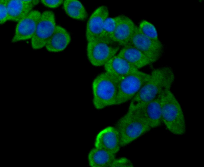 ICC staining LOX1 in LOVO cells (green). The nuclear counter stain is DAPI (blue). Cells were fixed in paraformaldehyde, permeabilised with 0.25% Triton X100/PBS.
