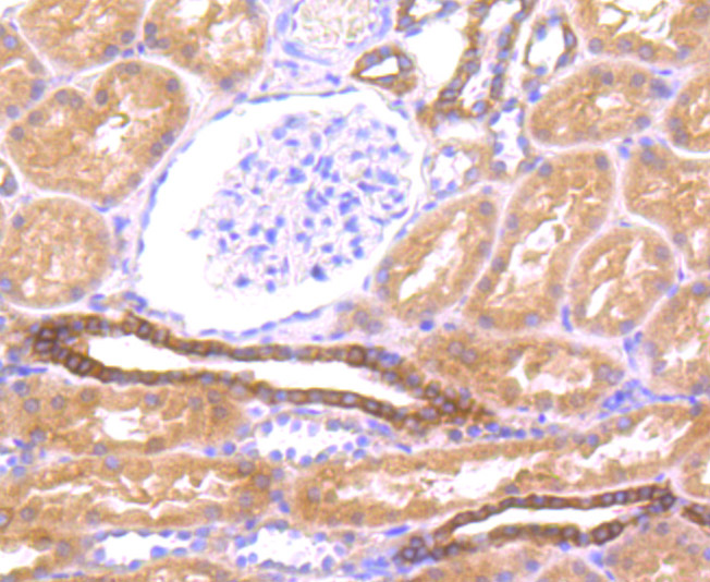 Immunohistochemical analysis of paraffin-embedded human kidney tissue using anti-LOX1 antibody. Counter stained with hematoxylin.