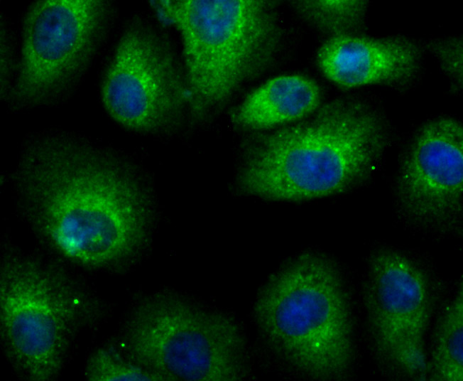 ICC staining of LRRK2 in A549 cells (green). Formalin fixed cells were permeabilized with 0.1% Triton X-100 in TBS for 10 minutes at room temperature and blocked with 1% Blocker BSA for 15 minutes at room temperature. Cells were probed with the primary antibody (ER1706-54, 1/100) for 1 hour at room temperature, washed with PBS. Alexa Fluor®488 Goat anti-Rabbit IgG was used as the secondary antibody at 1/1,000 dilution. The nuclear counter stain is DAPI (blue).