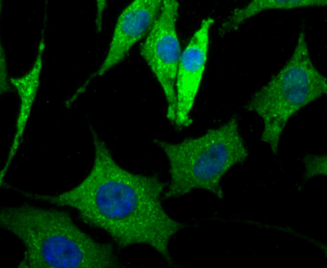 ICC staining of LRRK2 in SHSY5Y cells (green). Formalin fixed cells were permeabilized with 0.1% Triton X-100 in TBS for 10 minutes at room temperature and blocked with 1% Blocker BSA for 15 minutes at room temperature. Cells were probed with the primary antibody (ER1706-54, 1/100) for 1 hour at room temperature, washed with PBS. Alexa Fluor®488 Goat anti-Rabbit IgG was used as the secondary antibody at 1/1,000 dilution. The nuclear counter stain is DAPI (blue).