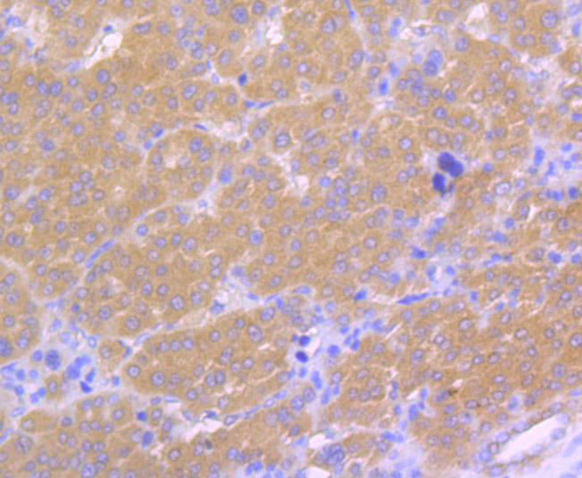 Immunohistochemical analysis of paraffin-embedded human liver tissue using anti-LRRK2 antibody. The section was pre-treated using heat mediated antigen retrieval with Tris-EDTA buffer (pH 8.0-8.4) for 20 minutes.The tissues were blocked in 5% BSA for 30 minutes at room temperature, washed with ddH2O and PBS, and then probed with the primary antibody (ER1706-54, 1/200) for 30 minutes at room temperature. The detection was performed using an HRP conjugated compact polymer system. DAB was used as the chromogen. Tissues were counterstained with hematoxylin and mounted with DPX.