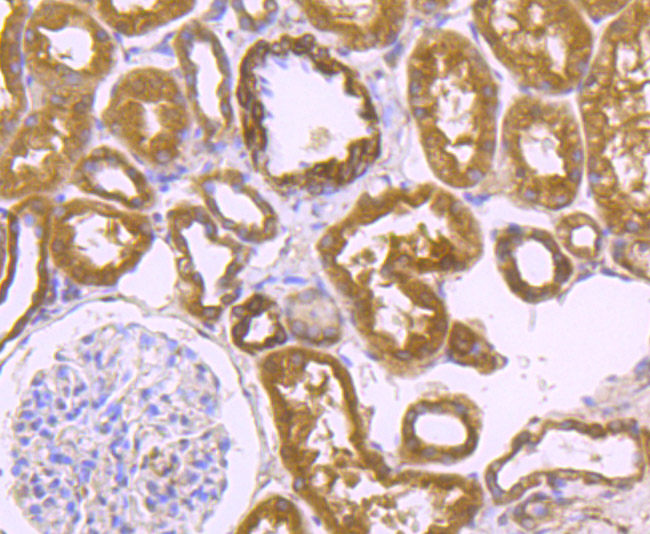 Immunohistochemical analysis of paraffin-embedded human kidney tissue using anti-LRRK2 antibody. The section was pre-treated using heat mediated antigen retrieval with Tris-EDTA buffer (pH 8.0-8.4) for 20 minutes.The tissues were blocked in 5% BSA for 30 minutes at room temperature, washed with ddH2O and PBS, and then probed with the primary antibody (ER1706-54, 1/50) for 30 minutes at room temperature. The detection was performed using an HRP conjugated compact polymer system. DAB was used as the chromogen. Tissues were counterstained with hematoxylin and mounted with DPX.