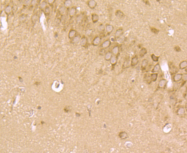 Immunohistochemical analysis of paraffin-embedded mouse brain tissue using anti-LRRK2 antibody. The section was pre-treated using heat mediated antigen retrieval with Tris-EDTA buffer (pH 8.0-8.4) for 20 minutes.The tissues were blocked in 5% BSA for 30 minutes at room temperature, washed with ddH2O and PBS, and then probed with the primary antibody (ER1706-54, 1/200) for 30 minutes at room temperature. The detection was performed using an HRP conjugated compact polymer system. DAB was used as the chromogen. Tissues were counterstained with hematoxylin and mounted with DPX.