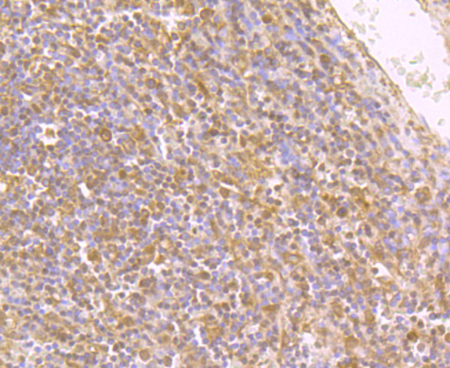 Immunohistochemical analysis of paraffin-embedded human spleen tissue using anti-IL4 antibody. Counter stained with hematoxylin.