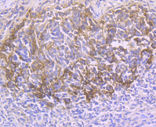 Immunohistochemical analysis of paraffin-embedded human tonsil tissue using anti-CD21 antibody. Counter stained with hematoxylin.