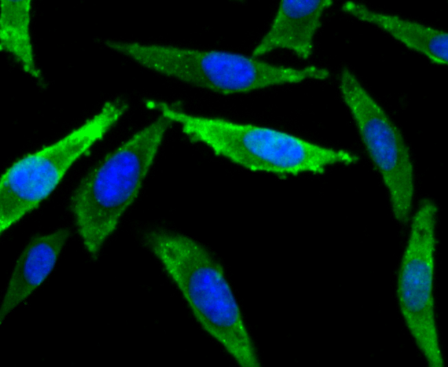 ICC staining NaV1.7 in SH-SY5Y cells (green). The nuclear counter stain is DAPI (blue). Cells were fixed in paraformaldehyde, permeabilised with 0.25% Triton X100/PBS.
