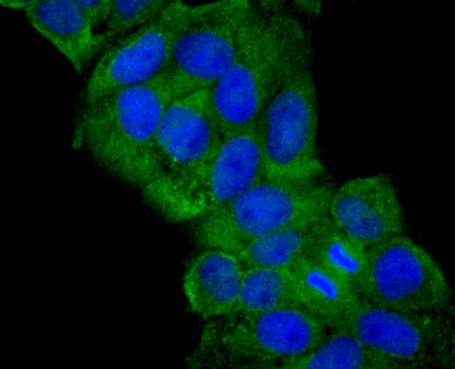 ICC staining JAK2 in Hela cells (green). The nuclear counter stain is DAPI (blue). Cells were fixed in paraformaldehyde, permeabilised with 0.25% Triton X100/PBS.