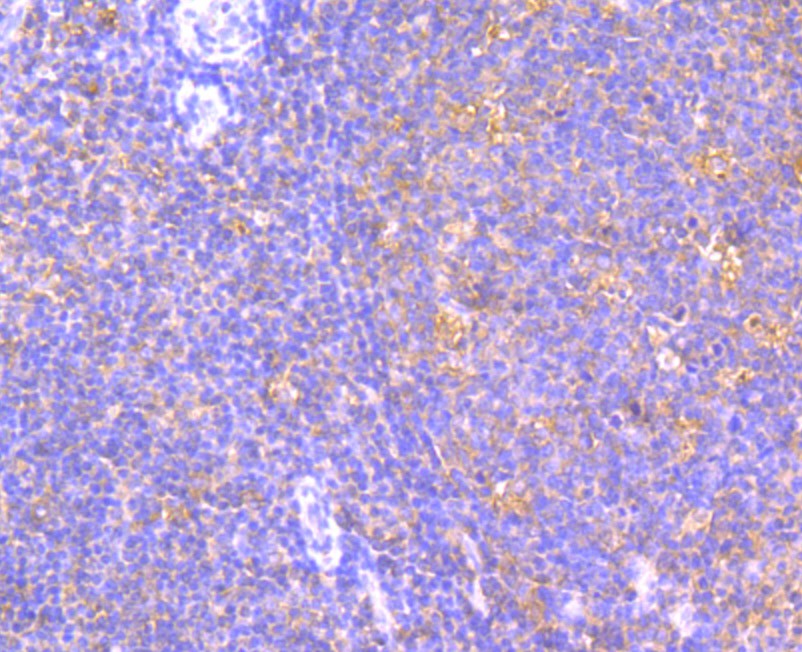 Immunohistochemical analysis of paraffin-embedded human tonsil tissue using anti-JAK2 antibody. Counter stained with hematoxylin.